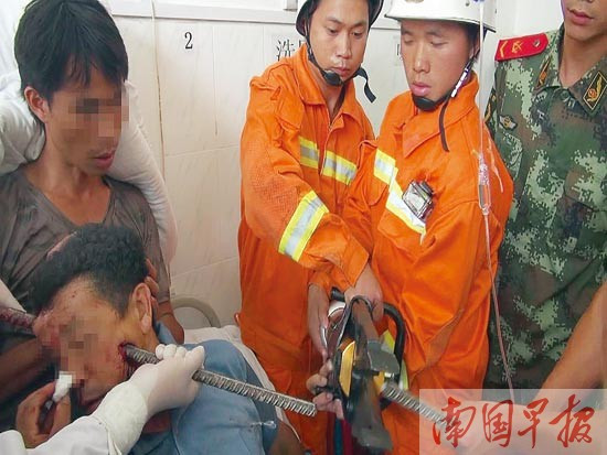 Sống sót sau khi bị thanh sắt đâm xuyên đầu ảnh 1