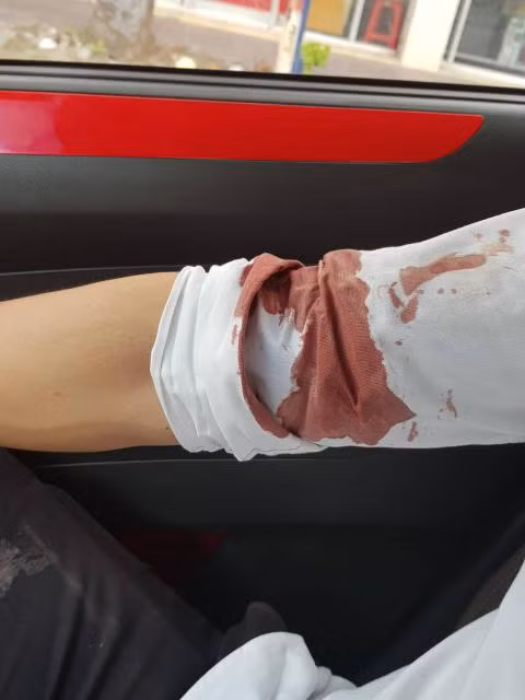 Phóng viên bị ôtô đâm, hành hung: Điện thoại mất ảnh 1