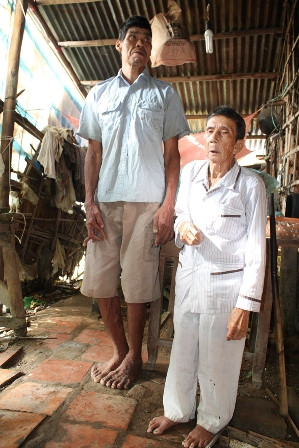 Đời cơ cực của “gã khổng lồ” cao hơn 2m ảnh 1