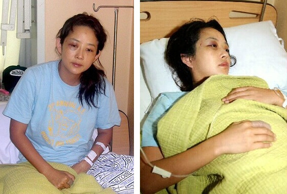 Những sao nữ châu Á từng bị chồng bạo hành dã man trong nhiều năm ảnh 2