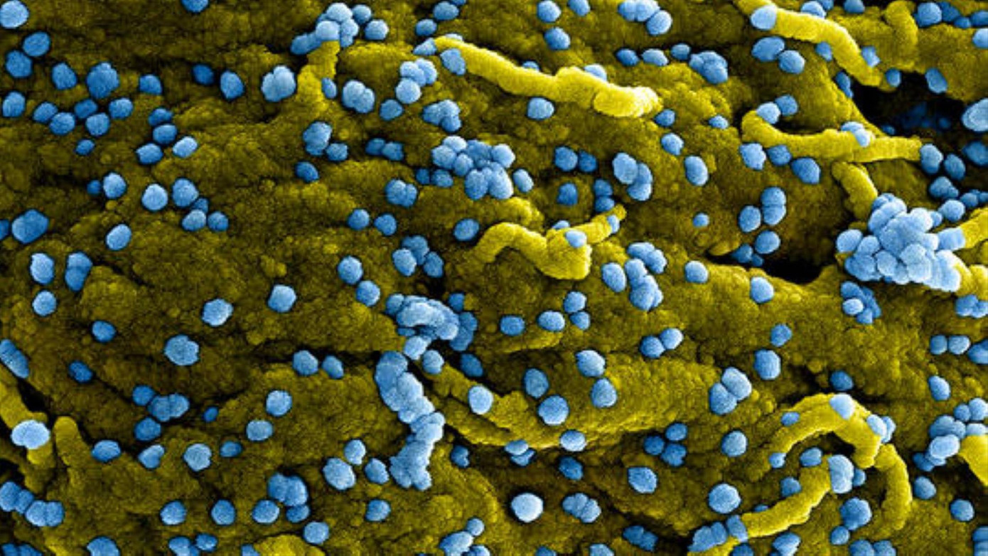 Tên của virus được lấy từ phòng thí nghiệm Marburg nước Đức - nơi phát hiện ra loại virus này vào năm 1967