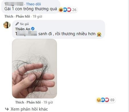 Hình ảnh nắm tóc rụng sau sinh của Thiên An khiến nhiều người đồng cảm. Hình ảnh nắm tóc rụng sau sinh của Thiên An khiến nhiều người đồng cảm.