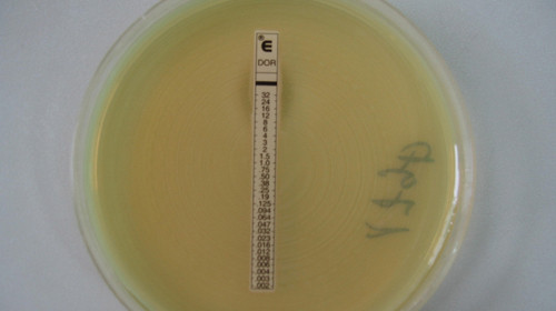 Vi khuẩn kháng thuốc nhóm carbapenem ở bệnh nhân điều trị tại Bệnh viện Bệnh nhiệt đới T.Ư - h tư liệu do bệnh viện cung cấp