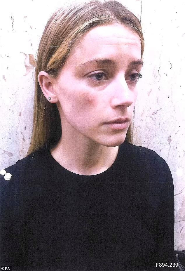 Hình ảnh phía Amber Heard cung cấp trong vụ kiện để làm bằng chứng tố Johnny Depp bạo hành. Hình ảnh phía Amber Heard cung cấp trong vụ kiện để làm bằng chứng tố Johnny Depp bạo hành.