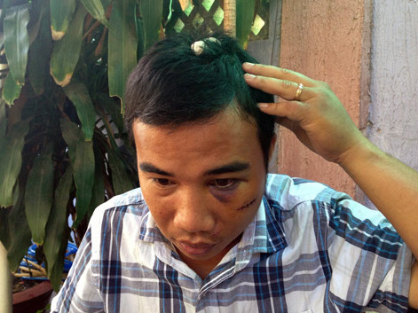 Nguyễn Nhật Trường với nhiều vết thương vùng đầu và mặt. Ảnh: Thanh niên Nguyễn Nhật Trường với nhiều vết thương vùng đầu và mặt