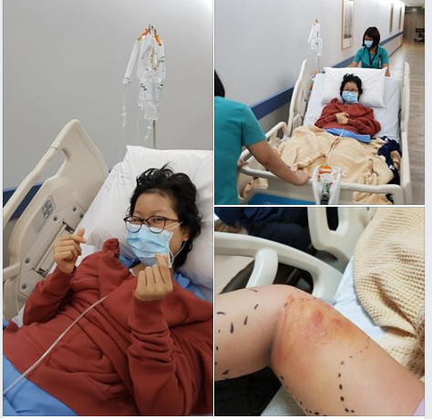 Xót xa con gái đạo diễn Đỗ Đức Thành phải mổ đi cánh tay ảnh 3