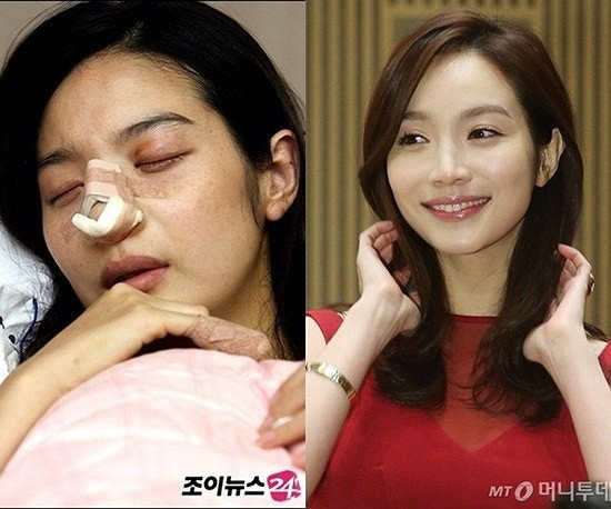 Showbiz 28/8: NSND Lan Hương từng vào viện vì vòng 1 'cứ đập mắt người đối diện' ảnh 5