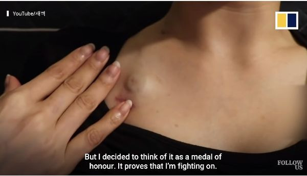 Ngưỡng mộ tinh thần 'chiến đấu' với ung thư của hot girl Hàn Quốc ảnh 4