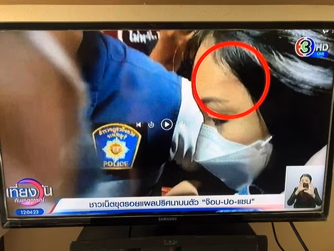 Vết xước trên trán... - Ảnh: CH3