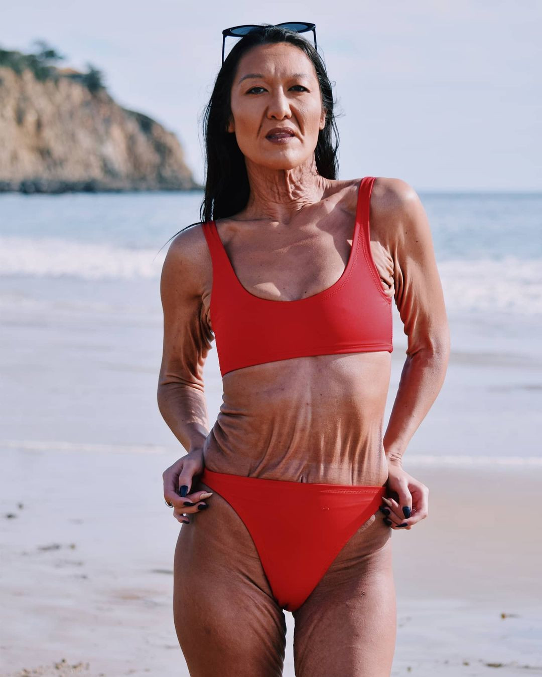 Ngoài chứng rối loạn da, những năm qua, Sara thỉnh thoảng phải nhập viện do chứng mất ổn định cổ tử cung. Dù vậy, cô vẫn giữ tinh thần lạc quan, vui vẻ. Năm 2022, cô tham dự một hội nghị về Hội chứng Ehler-Danloss. Cô cho biết học được rất nhiều điều mới về căn bệnh.