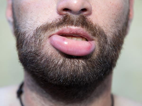 Ảnh: Boldsky. nhin-doi-moi-doan-benh-1