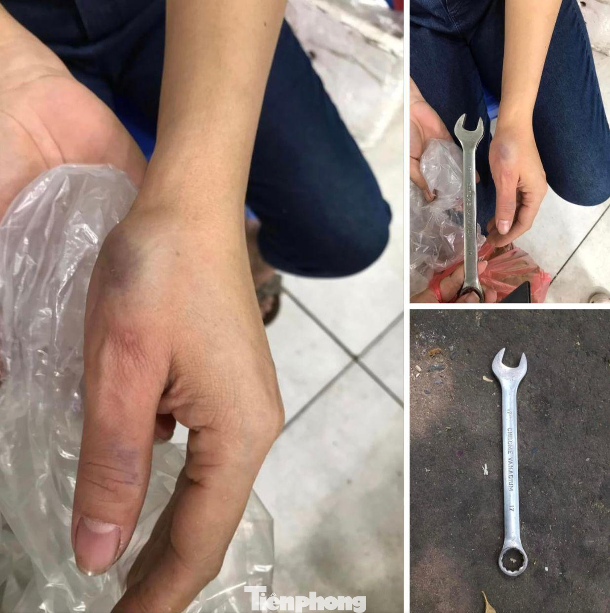 Chiếc cờ lê bằng sắt rơi trúng tay một người phụ nữ ở chung cư HH Linh Đàm. Ảnh: NVCC