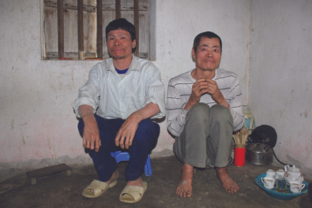 Hai anh em ông Đô và Tô đang kể về bệnh tình. Ảnh: Lao Động