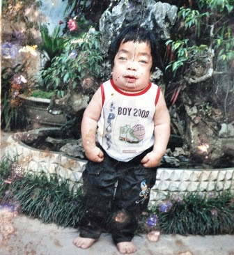 Em Trần Văn Đức lúc còn sống, khi 13 tuổi chẳng khác gì đứa trẻ lên 3..