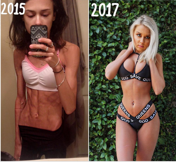 Đây là cách cô gái 'lột xác' từ bộ xương di động thành đồng hồ cát nóng bỏng ảnh 1