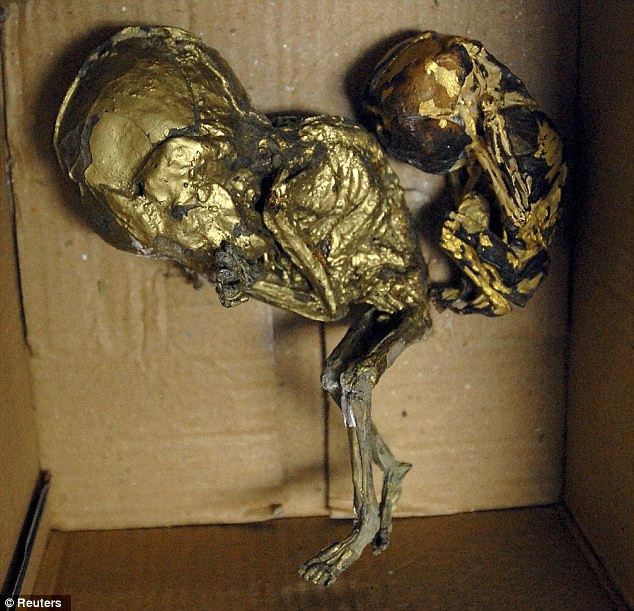 Rùng rợn bào thai dát vàng. Rùng rợn bào thai dát vàng