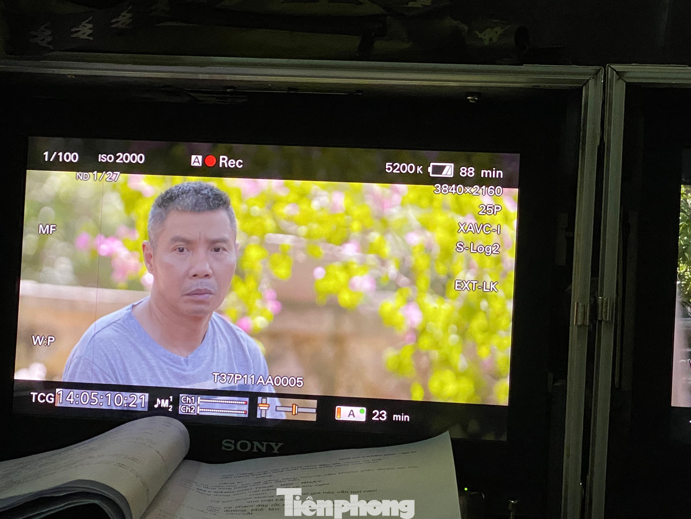 Tháng 7/2021, NSND Công Lý nhập viện cấp cứu sau khi bị ngã do trượt chân trên sàn nhà và phải nhập viện điều trị trong 3 tháng. Sau khi xuất viện, anh tiếp tục điều trị theo phác đồ riêng của bác sĩ. "Hiện tại, sức khỏe anh Lý tốt, tinh thần phấn chấn, ăn được ngủ được. Anh cũng chăm chỉ tập thể dục, trị liệu để nhanh chóng lấy lại sức khỏe cũng như vóc dáng. Không chỉ thế, thỉnh thoảng anh Lý còn giúp tôi làm việc nhà”, bà xã NSND Công Lý tiết lộ. Những lần sang Nhật Bản điều trị bệnh cũng giúp sức khỏe nam nghệ sĩ tốt lên trông thấy. Tháng 7/2021, NSND Công Lý nhập viện cấp cứu sau khi bị ngã do trượt chân trên sàn nhà và phải nhập viện điều trị trong 3 tháng. Sau khi xuất viện, anh tiếp tục điều trị theo phác đồ riêng của bác sĩ. "Hiện tại, sức khỏe anh Lý tốt, tinh thần phấn chấn, ăn được ngủ được. Anh cũng chăm chỉ tập thể dục, trị liệu để nhanh chóng lấy lại sức khỏe cũng như vóc dáng. Không chỉ thế, thỉnh thoảng anh Lý còn giúp tôi làm việc nhà”, bà xã NSND Công Lý tiết lộ. Những lần sang Nhật Bản điều trị bệnh cũng giúp sức khỏe nam nghệ sĩ tốt lên trông thấy.