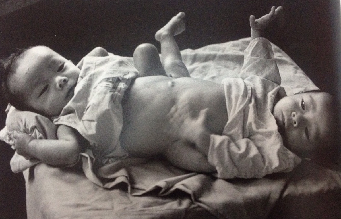 Anh em Việt - Đức lúc mới sinh. Ảnh tư liệu.