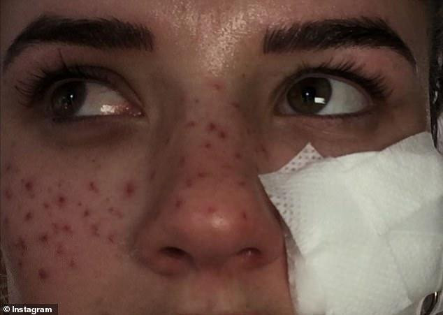 Gương mặt Tilly Whitfield sau khi tới bệnh viện chữa trị Gương mặt Tilly Whitfield sau khi tới bệnh viện chữa trị