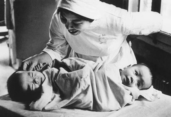 Anh em Việt - Đức lúc mới sinh. Ảnh tư liệu.