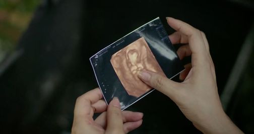 Phương đốt hết giấy tờ khám thai, nói lời tạm biệt đứa con chưa kịp chào đời. Phương đốt hết giấy tờ khám thai, nói lời tạm biệt đứa con chưa kịp chào đời.