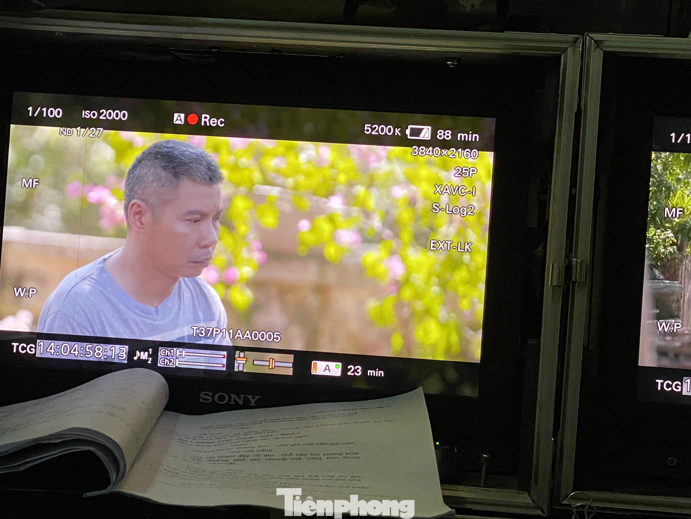 Tháng 7/2021, NSND Công Lý nhập viện cấp cứu sau khi bị ngã do trượt chân trên sàn nhà và phải nhập viện điều trị trong 3 tháng. Sau khi xuất viện, anh tiếp tục điều trị theo phác đồ riêng của bác sĩ. "Hiện tại, sức khỏe anh Lý tốt, tinh thần phấn chấn, ăn được ngủ được. Anh cũng chăm chỉ tập thể dục, trị liệu để nhanh chóng lấy lại sức khỏe cũng như vóc dáng. Không chỉ thế, thỉnh thoảng anh Lý còn giúp tôi làm việc nhà”, bà xã NSND Công Lý tiết lộ. Những lần sang Nhật Bản điều trị bệnh cũng giúp sức khỏe nam nghệ sĩ tốt lên trông thấy. Tháng 7/2021, NSND Công Lý nhập viện cấp cứu sau khi bị ngã do trượt chân trên sàn nhà và phải nhập viện điều trị trong 3 tháng. Sau khi xuất viện, anh tiếp tục điều trị theo phác đồ riêng của bác sĩ. "Hiện tại, sức khỏe anh Lý tốt, tinh thần phấn chấn, ăn được ngủ được. Anh cũng chăm chỉ tập thể dục, trị liệu để nhanh chóng lấy lại sức khỏe cũng như vóc dáng. Không chỉ thế, thỉnh thoảng anh Lý còn giúp tôi làm việc nhà”, bà xã NSND Công Lý tiết lộ. Những lần sang Nhật Bản điều trị bệnh cũng giúp sức khỏe nam nghệ sĩ tốt lên trông thấy.