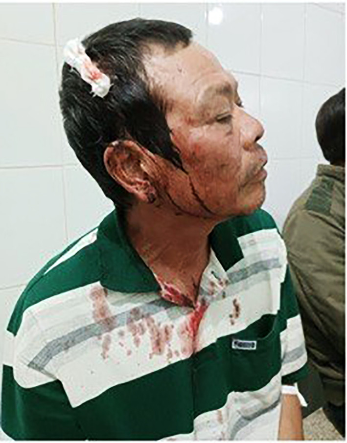 Ông Trúc bị thương ở đầu và lưng