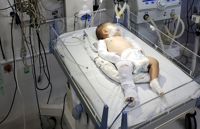 Nạn nhân đang được điều trị tích cực tại Bệnh viện đa khoa Lâm Đồng