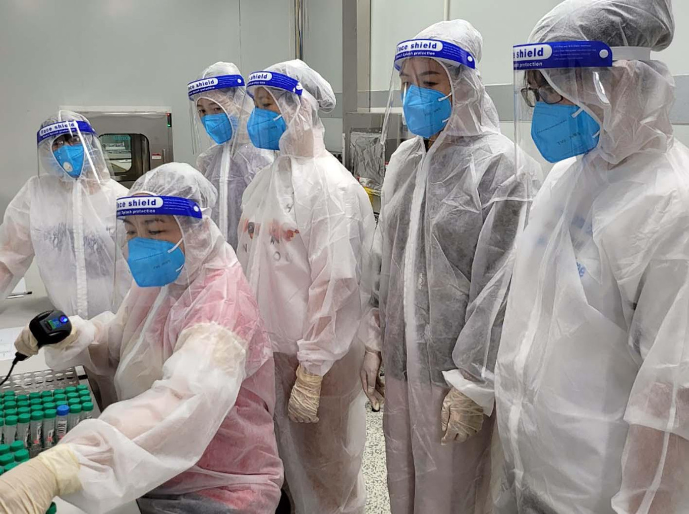 Xét nghiệm SARS-CoV-2 theo phương pháp RT-PCR Xét nghiệm SARS-CoV-2 theo phương pháp RT-PCR