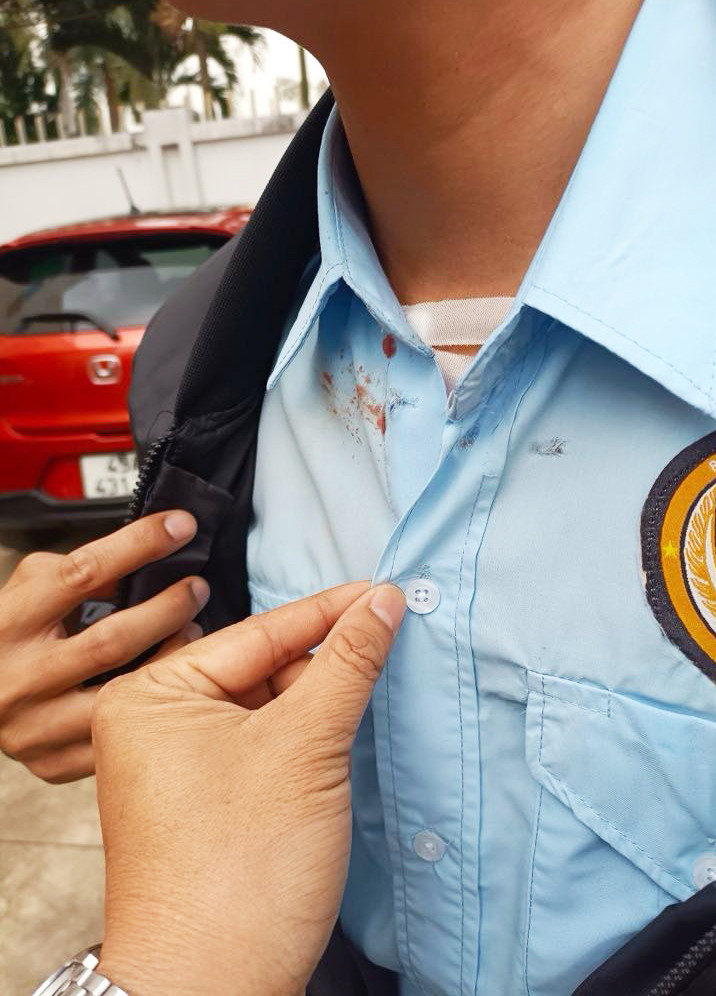 Viên đạn sượt qua vùng cổ của người bảo vệ ngân hàng