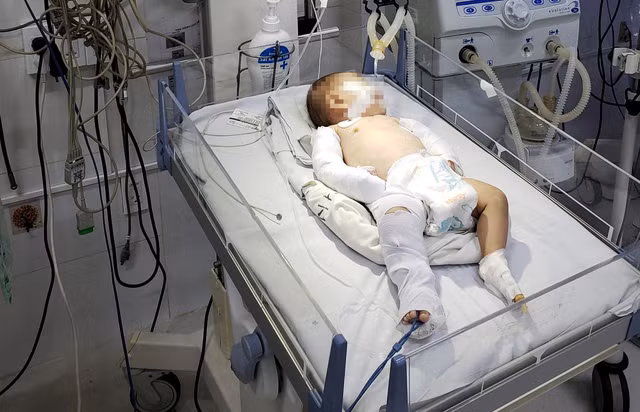Cháu bé đang được điều trị tích cực tại bệnh viện