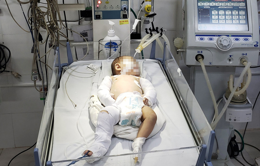 Bé gái gần 3 tháng tuổi bị người tình của mẹ bạo hành Bé gái gần 3 tháng tuổi bị người tình của mẹ bạo hành