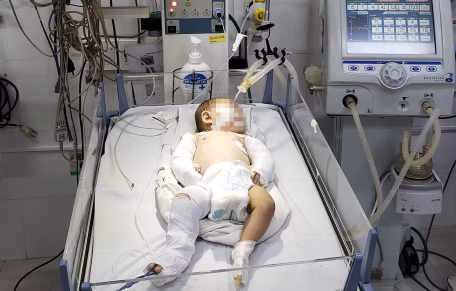 Bé gái gần 3 tháng tuổi bị người tình của mẹ bạo hành