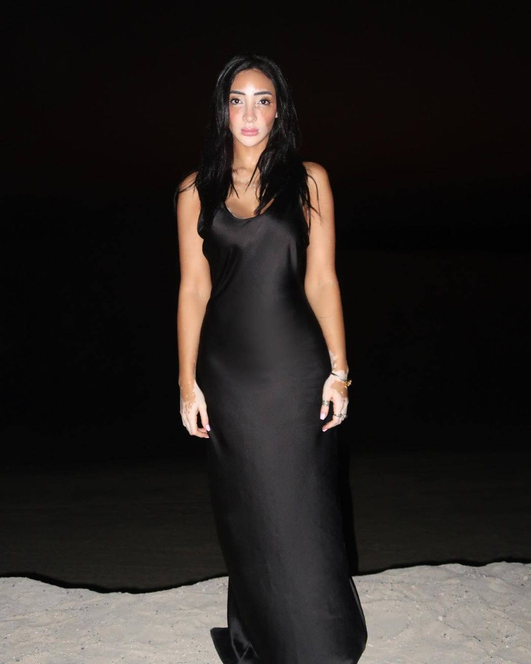 Cô sử dụng nền tảng của mình để truyền cảm hứng cho hàng nghìn người theo dõi thông qua việc thay đổi các tiêu chuẩn sắc đẹp đầy thách thức.