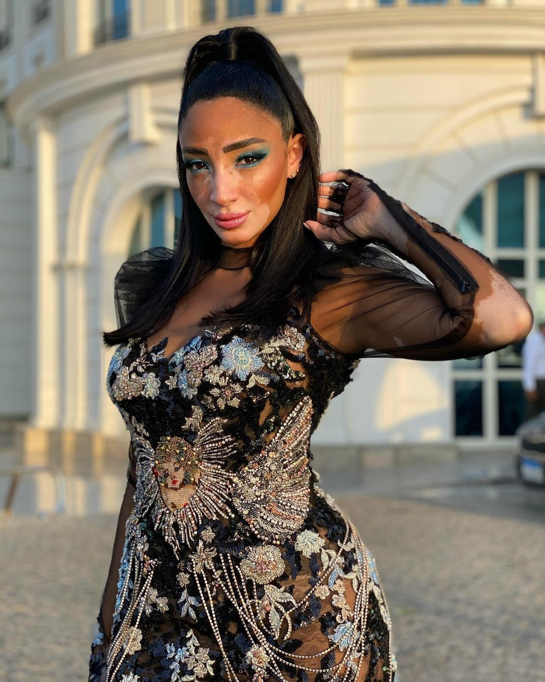 Bên cạnh công việc người mẫu, cô là nghệ sĩ trang điểm, người dẫn chương trình truyền hình và nhà hoạt động xã hội ủng hộ những người bị bệnh bạch biến.