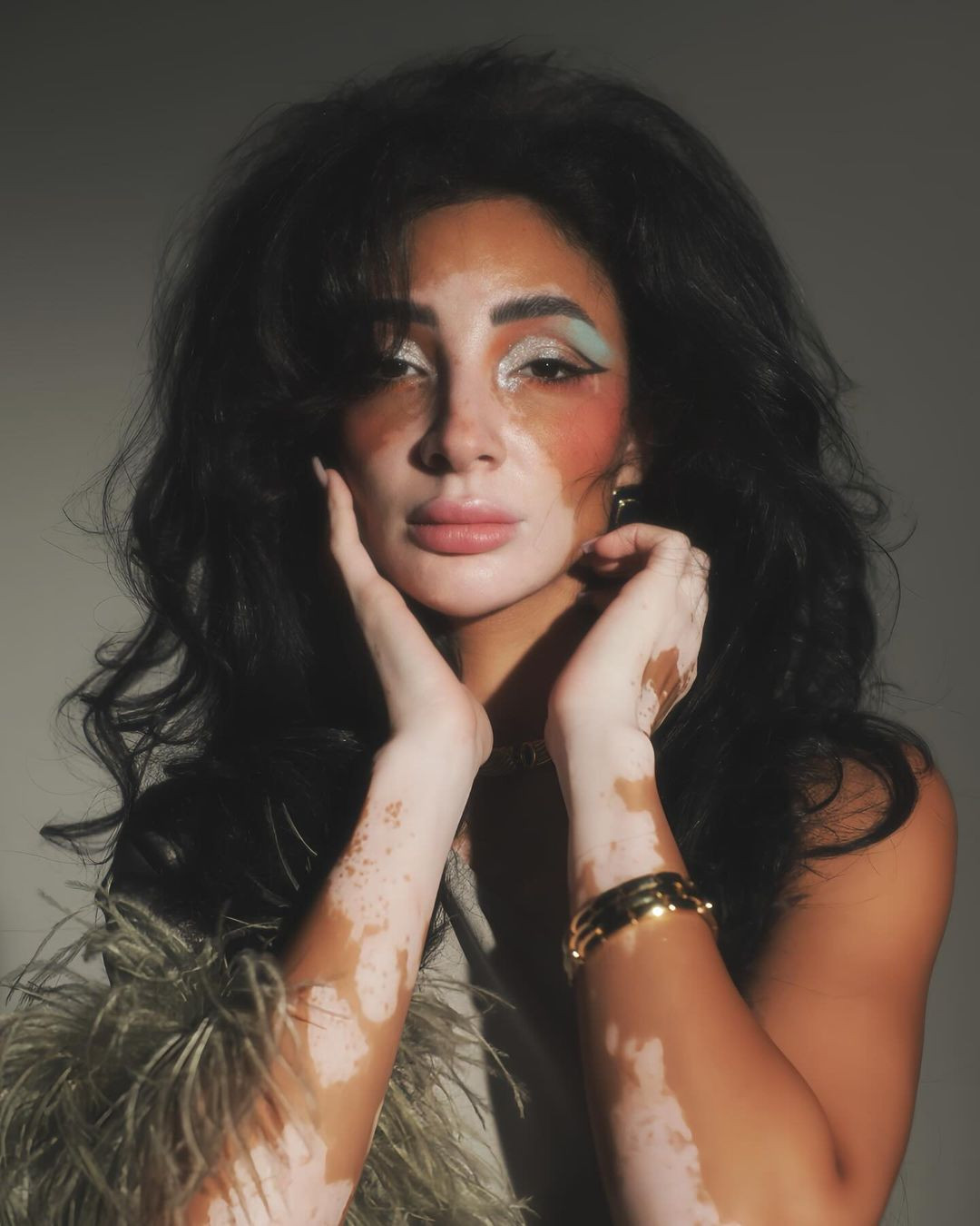 Cuộc thi Hoa hậu Hoàn vũ Ai Cập 2024 đã khởi động nhằm tìm kiếm đại diện tham dự Hoa hậu Hoàn vũ 2024 tổ chức ở Mexico. Trong số các thí sinh, người đẹp Logina Salah gây chú ý vì là người mẫu bạch biến.