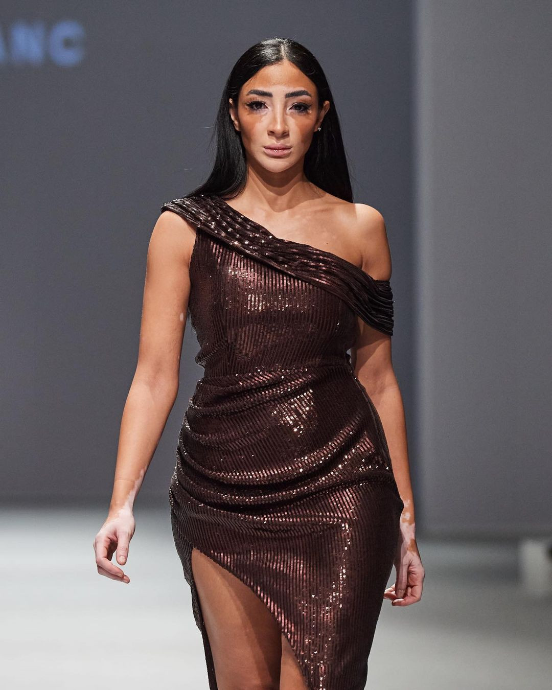 Bên cạnh công việc người mẫu, cô là nghệ sĩ trang điểm, người dẫn chương trình truyền hình và nhà hoạt động xã hội ủng hộ những người bị bệnh bạch biến.