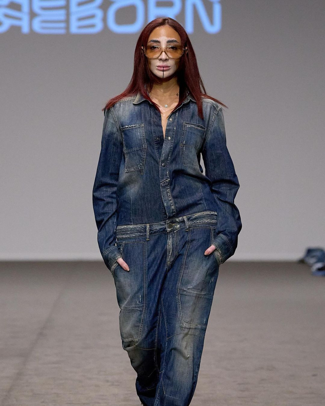 Vượt qua mặc cảm, Logina Salah theo đuổi sự nghiệp người mẫu và là một trong những người mẫu bạch biến nổi tiếng trên thế giới.