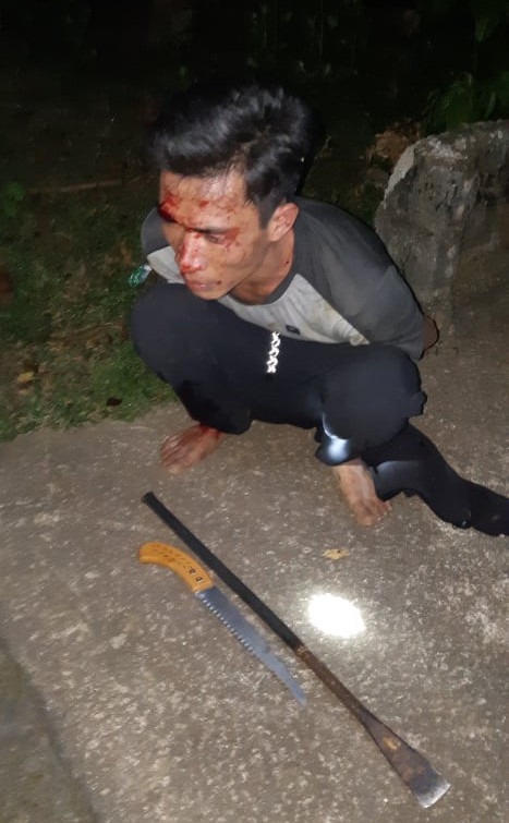 Nhiều công an nguy cơ phơi nhiễm HIV khi vây bắt 'sưa tặc' ảnh 1