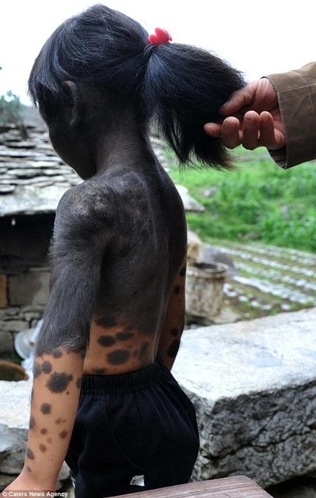 Lưng phủ đầy lông đen