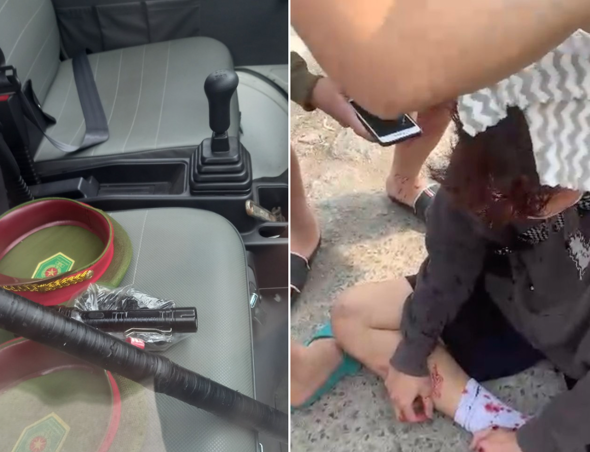 Chiếc gậy tang vật (trái) và nạn nhân. Chiếc gậy tang vật (trái) và nạn nhân.