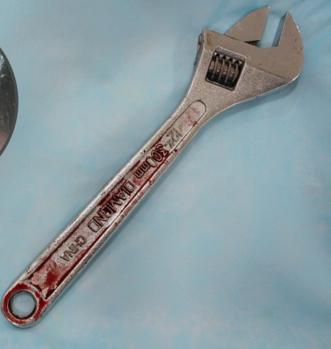 'Tự sướng' bằng mỏ lết, thanh niên phải nhập viện ảnh 2