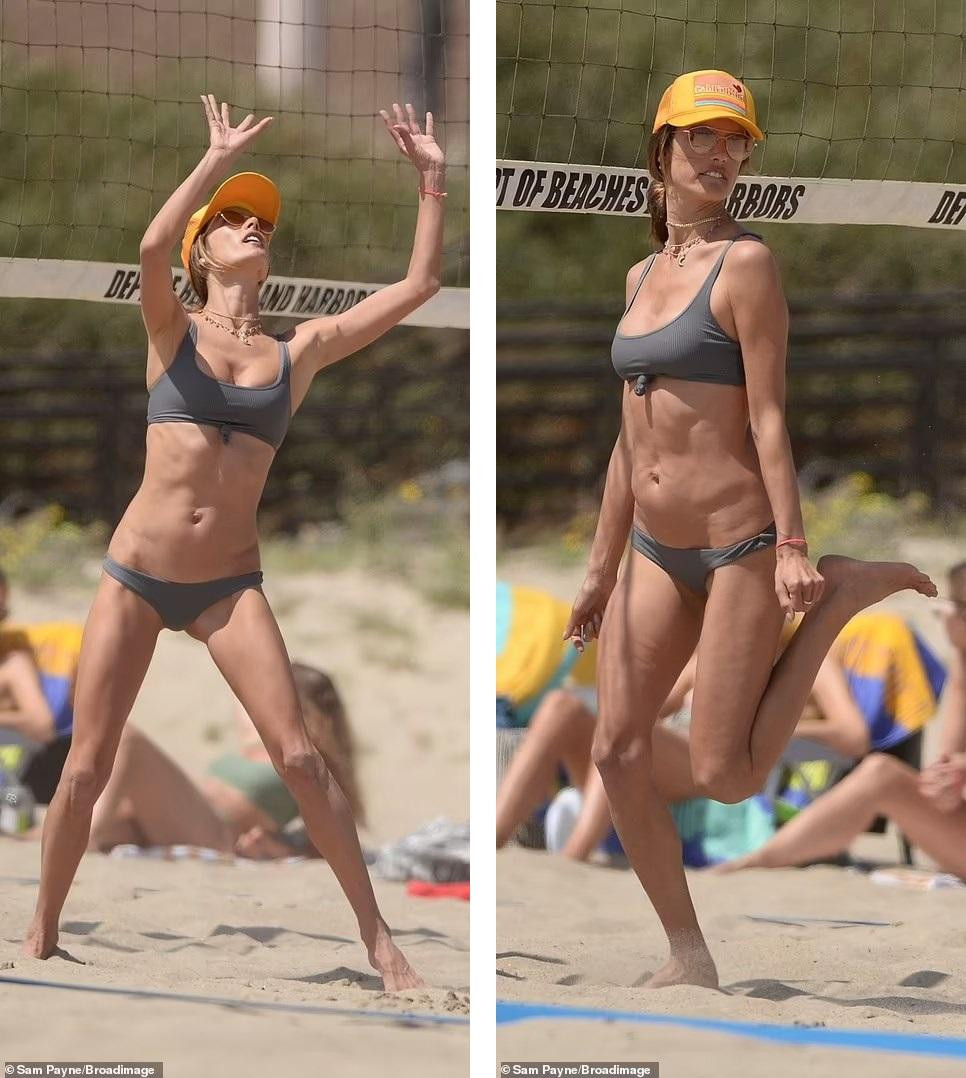 Người xem có thể thấy rõ phần xương sườn lộ ra và đầu gối &quot;củ lạc&quot;.