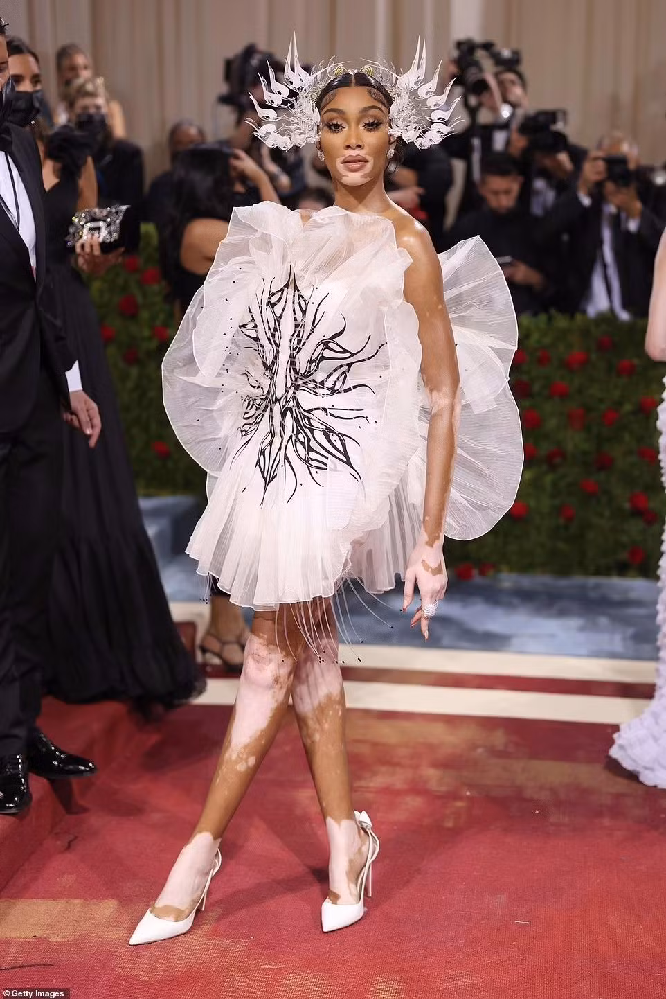 Người mẫu Winnie Harlow cũng bị nhận xét tương tự.