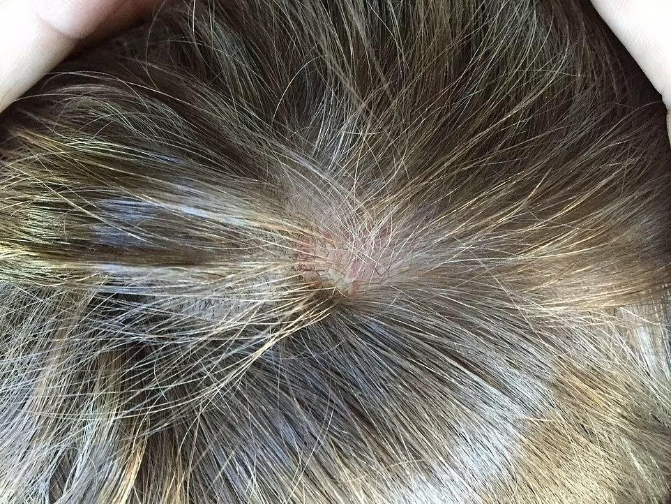 Những bức ảnh do phía Amber Heard cung cấp làm bằng chứng chống lại Johnny Depp.