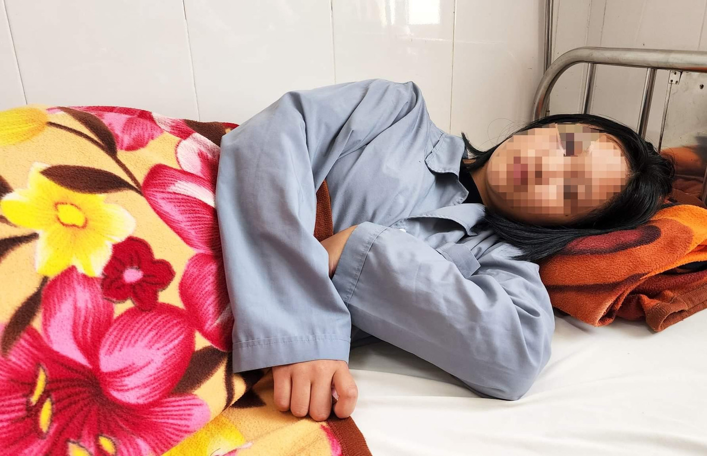 Mắt của nữ sinh L. sưng húp vì bị đánh