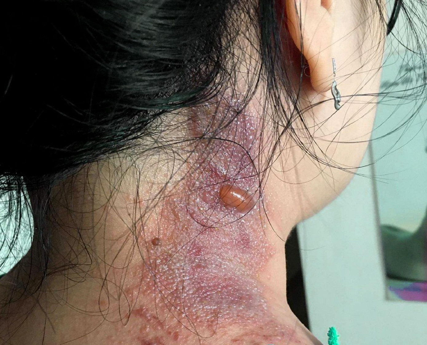 Cần chủ động các giải pháp để bảo vệ an toàn trước hiểm họa kiến ba khoang Cần chủ động các giải pháp để bảo vệ an toàn trước hiểm họa kiến ba khoang