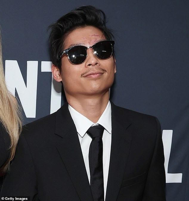 Angelina Jolie tìm bác sĩ thẩm mỹ hàng đầu xử lý vết sẹo lớn trên mặt Pax Thiên. Ảnh: Getty Images.