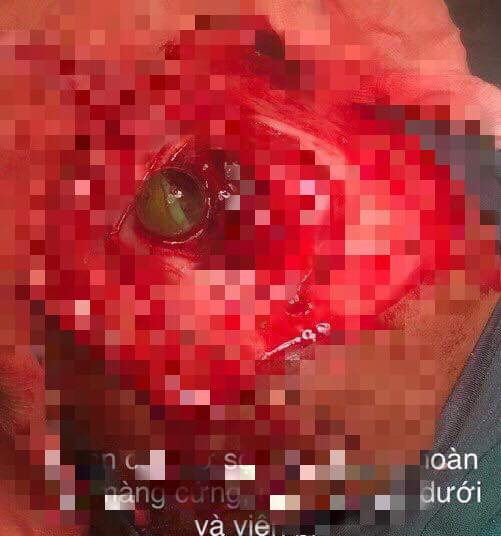 Nghịch súng tự chế của cậu, bé trai bị đạn bay xuyên não ảnh 1