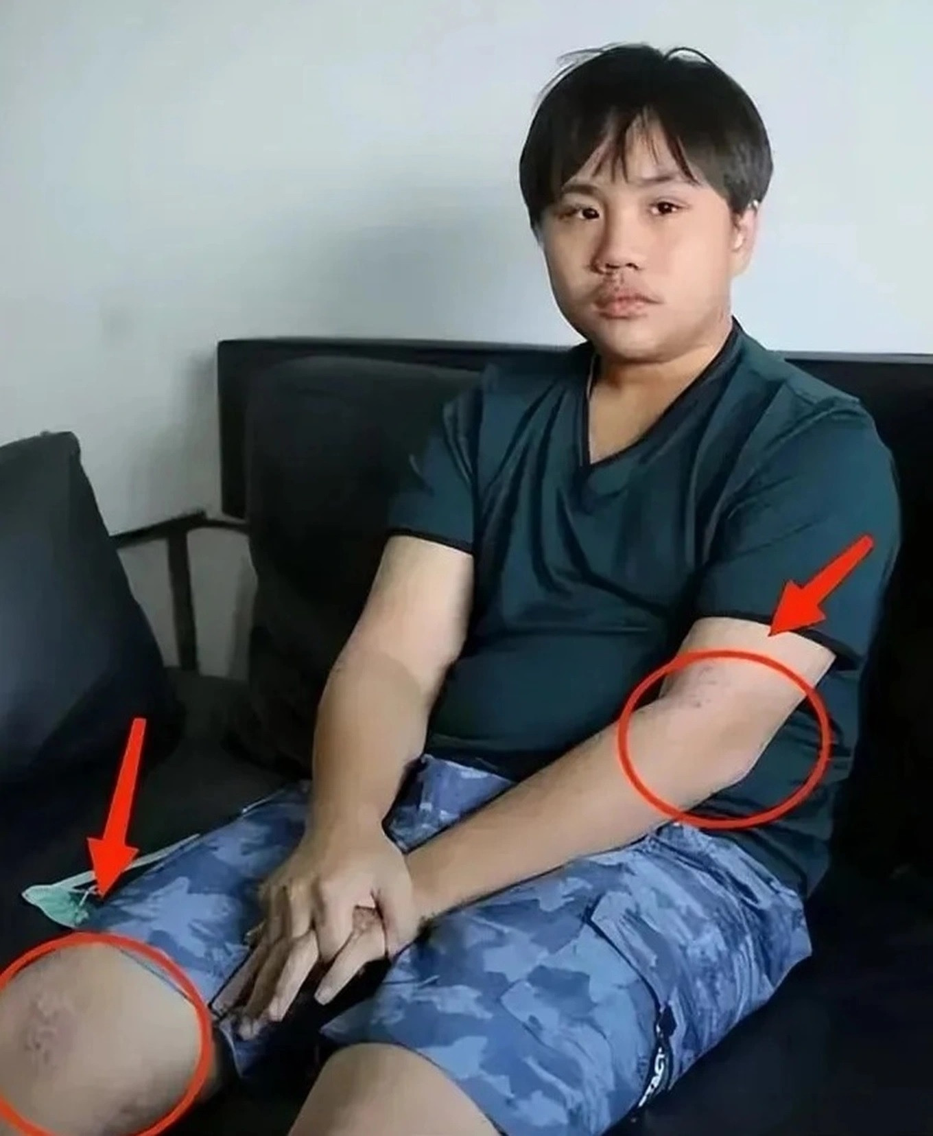 Tiểu Bân Bân bị cha coi là cỗ máy kiếm tiền khiến tuổi thơ của cậu phải làm việc vất vả, đến thời thiếu niên lại không có tiền chữa bệnh.